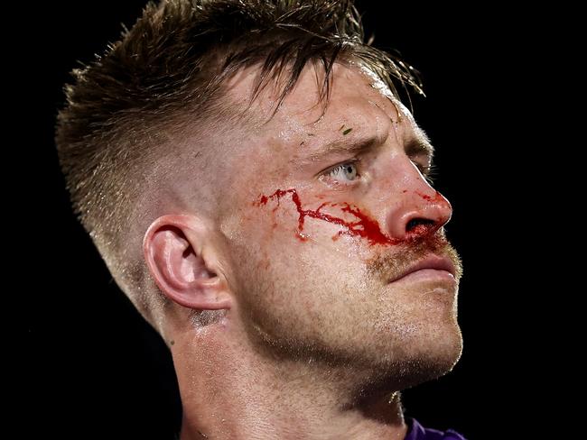 PENRITH, AUSTRALIA - AUGUST 15: Cameron Munster of the Storm leaves the field for a HIA test during the round 24 NRL match between Penrith Panthers and Melbourne Storm at BlueBet Stadium, on August 15, 2024, in Penrith, Australia. (Photo by Brendon Thorne/Getty Images)