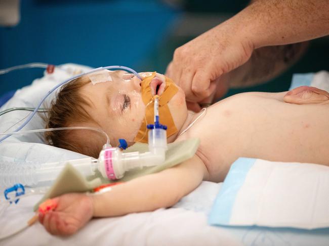 Hunter getting treatment for his rare condition. Picture: Mark Stewart