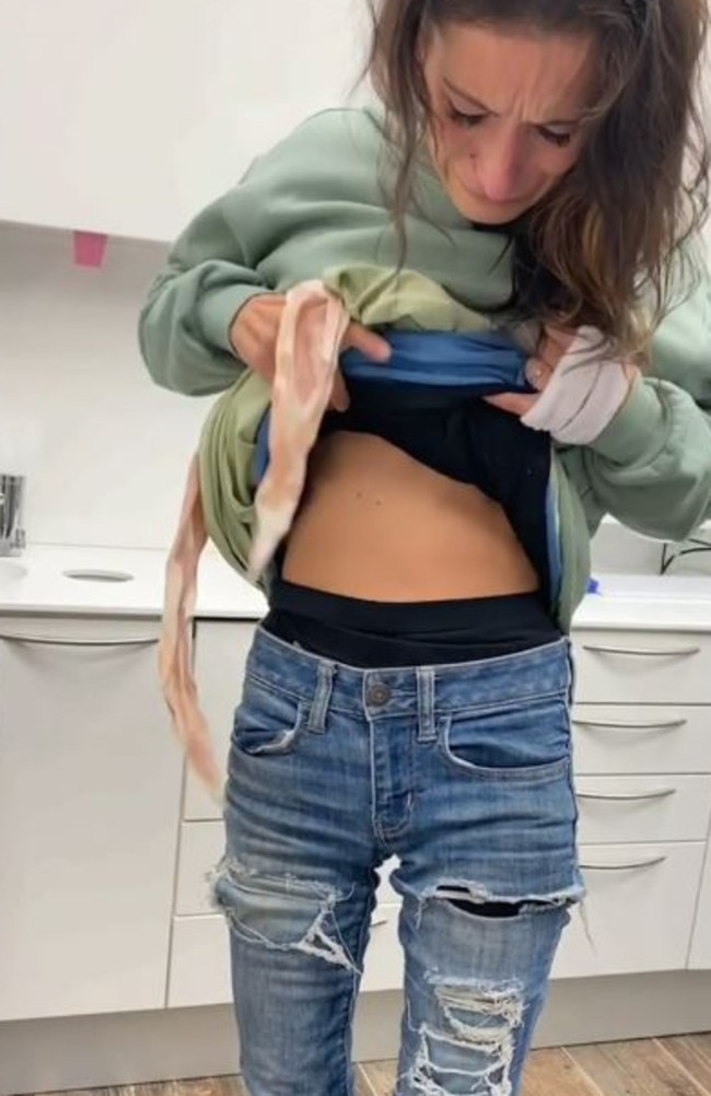 Unable to eat much, she dropped down to just 35kg after a dentist pulled her missing and rotten teeth out saying they were ‘unfixable’. Picture: TikTok/brittanynegler