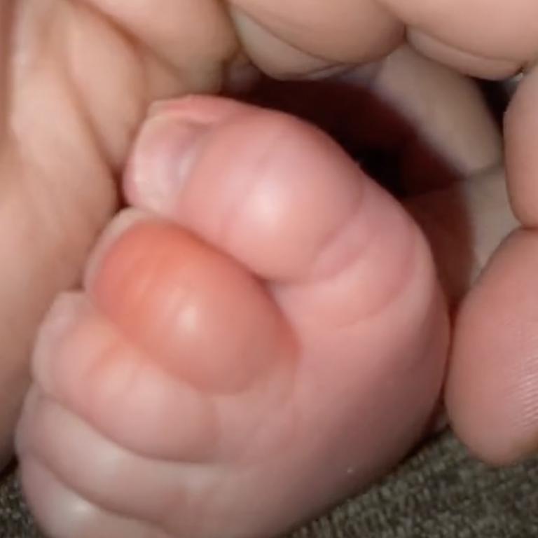 TikTok mum details frightening find on baby's toe: 'Another fear unlocked