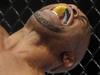UFC star returns from horrific injury