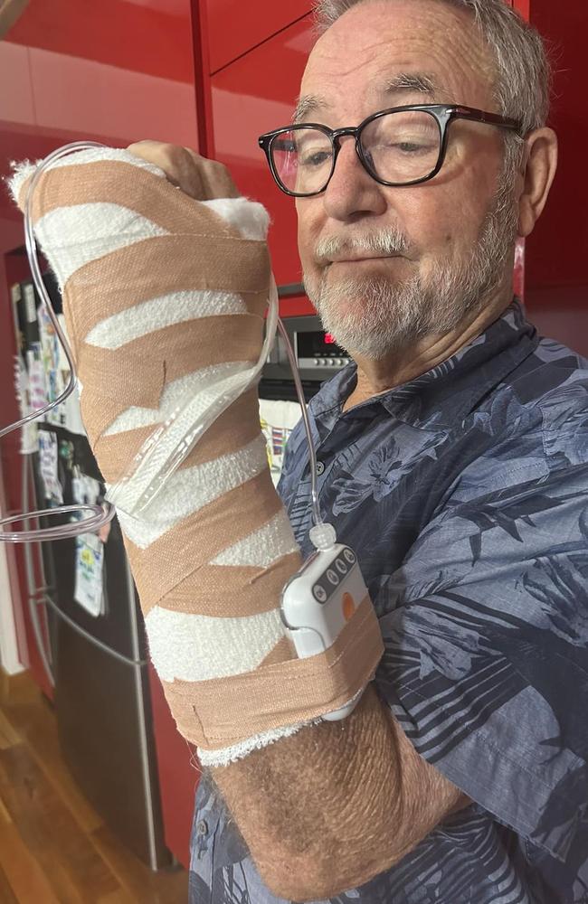 Beloved Australian musician John Williamson has sadly had to cancel upcoming Toowoomba and Queensland shows due to injury (Photo: Facebook)