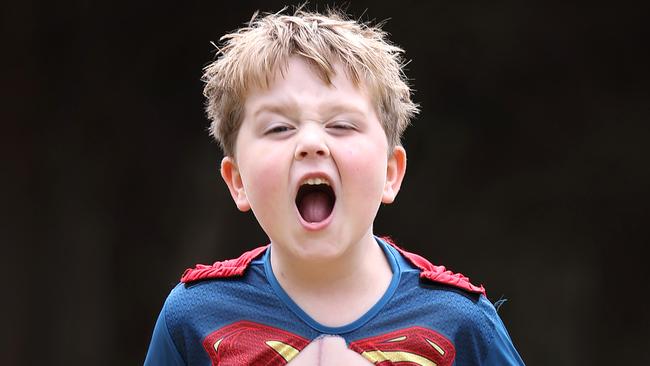 WARNING HOLD FOR Good Friday Appeal 2024 RCH. Xavier Grant 6, Kawasaki s disease. Left coronary heart bypass. Xavier shows his super hero zipper scar from his open heart surgery wearing his favourite super hero Superman at home in Warrnambool.                      Picture: David Caird