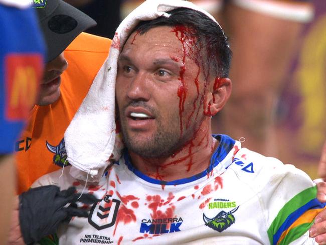 Bloody injury exposes ‘toxic’ NRL problem