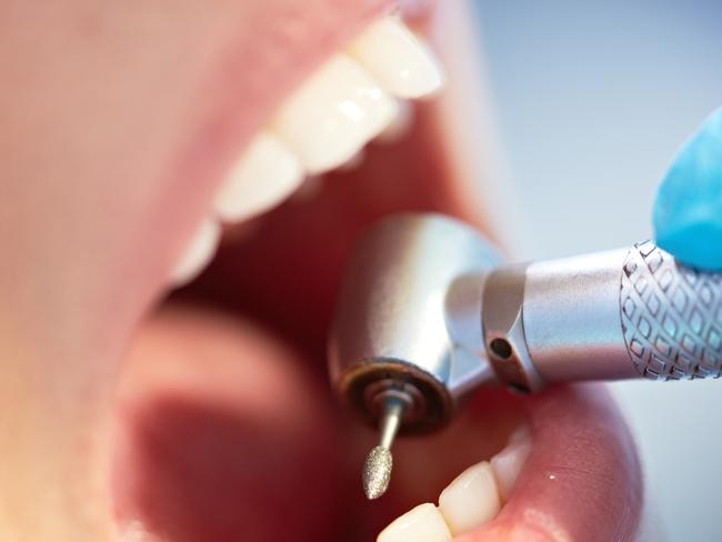 Smiles Inclusive generic dentist dental teeth. Photo: iStock