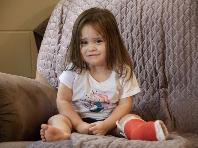 Two-year-old Rhylee Olsen suffered a fractured leg on Thursday, September 14. Picture: Brian Cassey