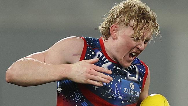 GEELONG, AUSTRALIA - JULY 07: Clayton Oliver of the Demons reacts after he was kicked in the hand during the round 17 AFL match between the Geelong Cats and the Melbourne Demons at GMHBA Stadium on July 07, 2022 in Geelong, Australia. (Photo by Robert Cianflone/Getty Images)