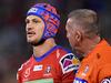NRL suddenly drops radical concussion news