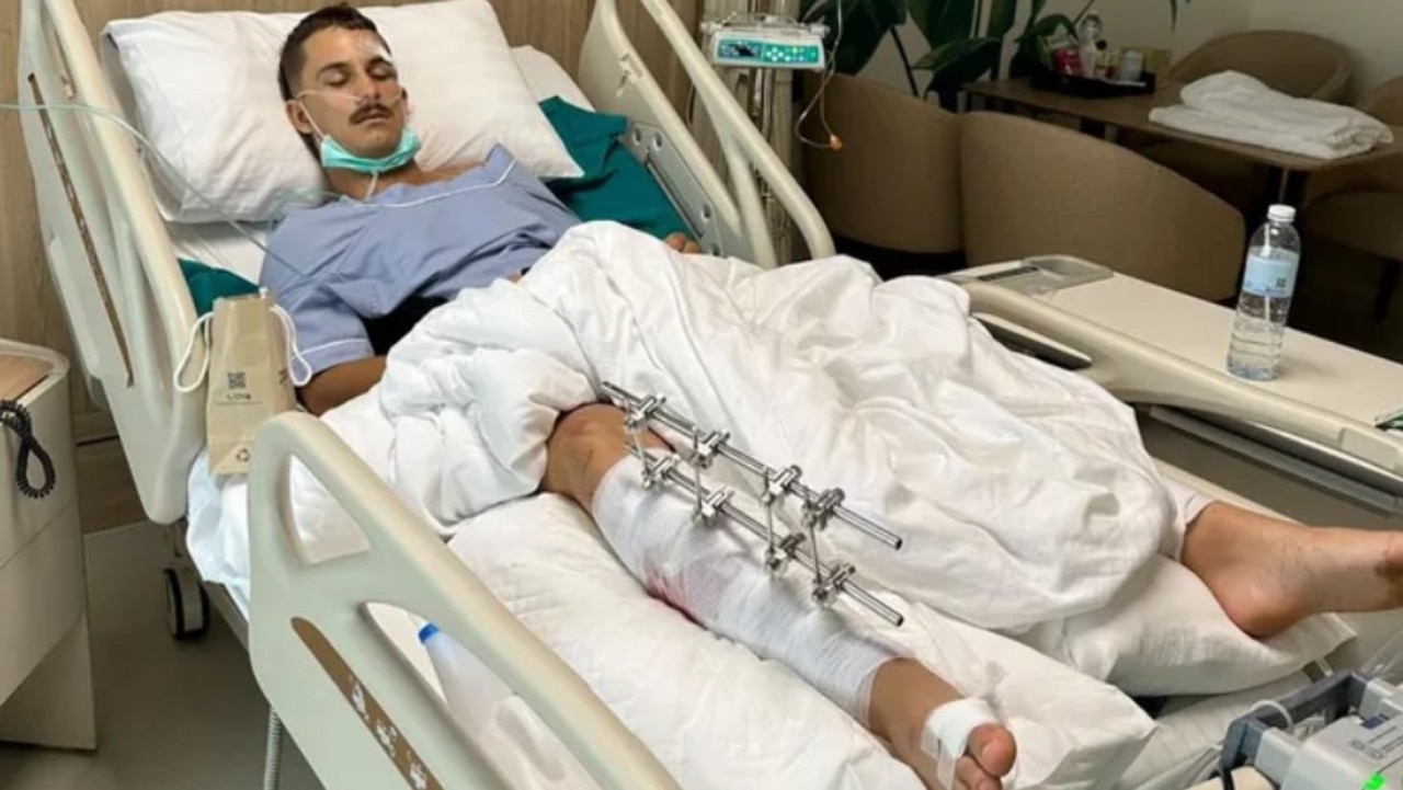 Australian man Tommy Kirk was hospitalised after a scooter incident in Thailand. Picture: GoFundMe