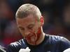 Manchester United's Nemanja Vidic, center, sustains a nose bleed during their English Premier League soccer match against Southampton at St Mary's stadium, Southampton, England, Sunday, May 11, 2014. (AP Photo/Sang Tan)