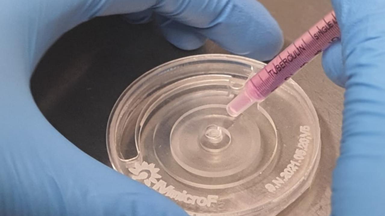 Why this ’exquisite’ device could change IVF treatment