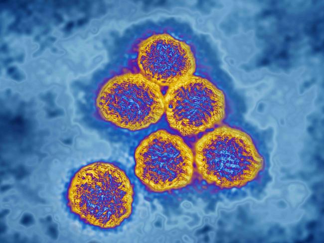 Flavivirus (family Flaviviridae), these viruses are responsible for yellow fever, dengue fever, Japanese encephalitis, Zika virus, West Nile encephalitis. They are transmitted by mosquitoes or ticks. image produced from transmission electron microscopy (viral diameter approximately 40 to 60 nm). (Photo by: CAVALLINI JAMES/BSIP/Universal Images Group via Getty Images)