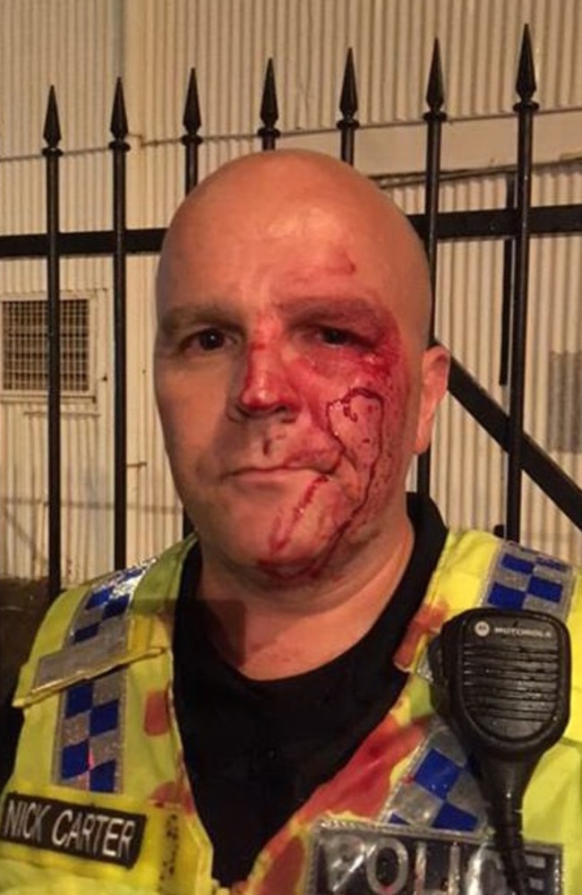 NT Police officer Nick Carter was coward punched outside Monsoons. He was knocked out and left bloodied and bruised from the attack. Picture: Supplied