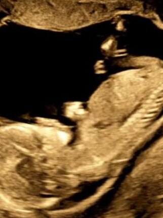 Rozee also shared a scan of the bub. Picture: Instagram,