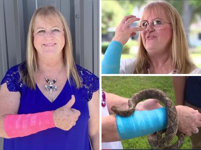 Woman attacked by snake and hawk at same time