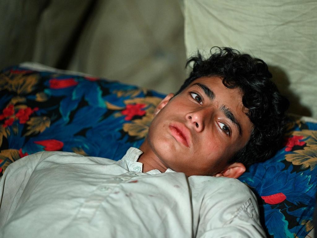 Cable car survivor Ibrar Ahmad is treated at a health care centre in the Pashto village of Khyber Pakhtunkhwa province. Picture: Farooq Naeem/AFP