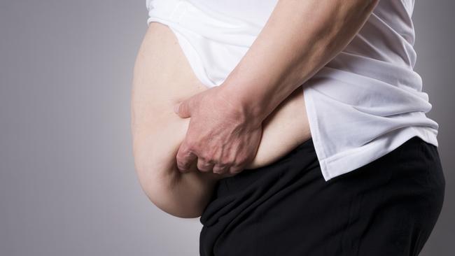 Doctors in Canada have been told to treat obese patients differently. Picture: istock