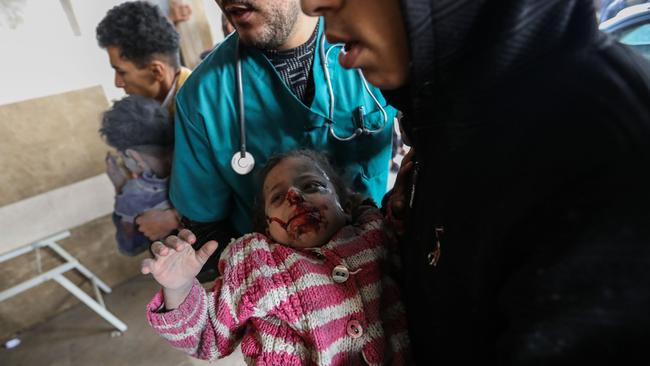 Young Palestinian girl severely injured by Israeli airstrike. Picture: Ahmad Hasaballah