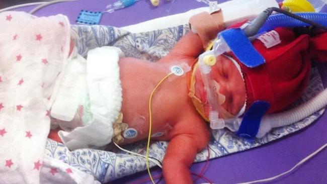 Harriet Elizabeth Johnston was born at 30 weeks and spent over eight weeks in the neonatal unit. Picture: Supplied by family