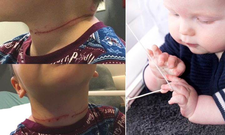 Blind cord strangulation: Mum shares horror photos