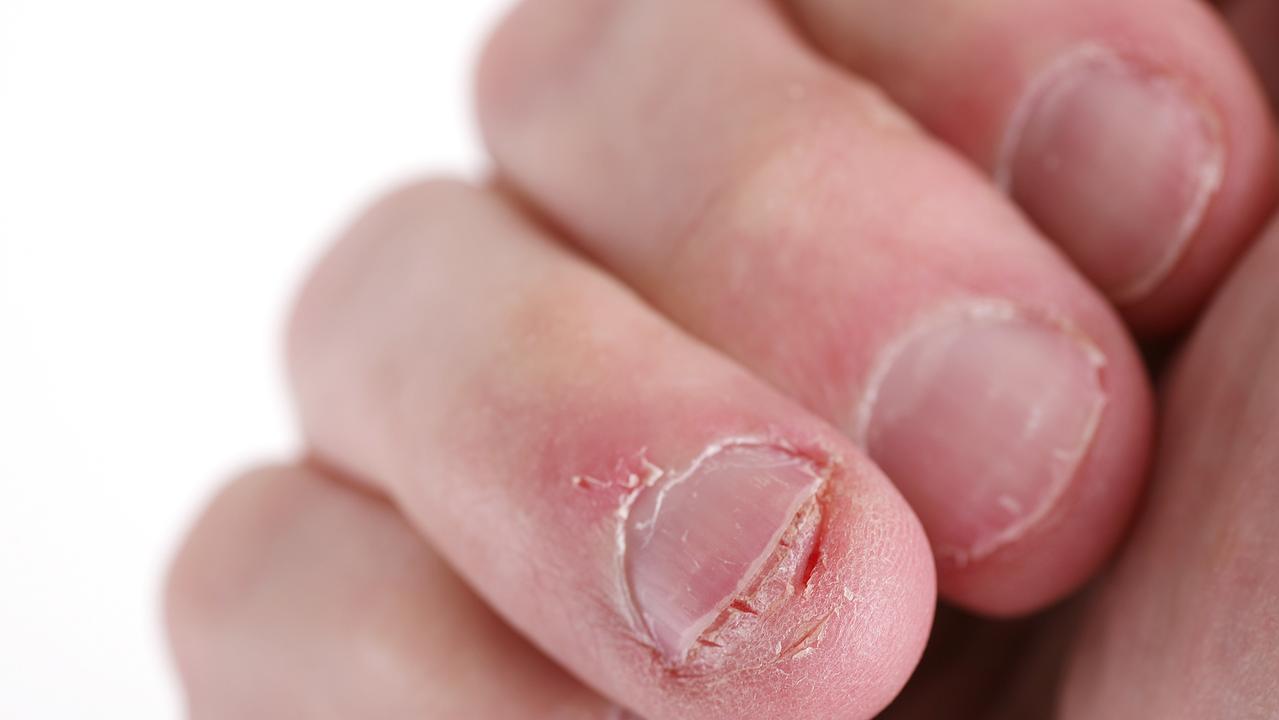 At any given time, there is an average of 50,430 live bacteria to be found per nail. Picture: iStock