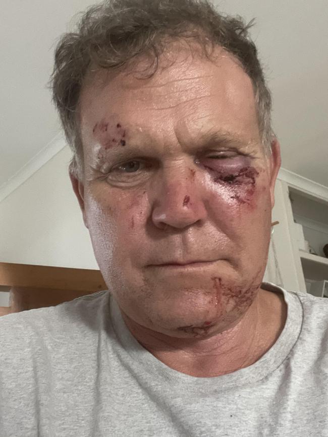 Holloways Beach resident and former Barron River MP Michael Trout was injured in an altercation in May. Picture: Supplied