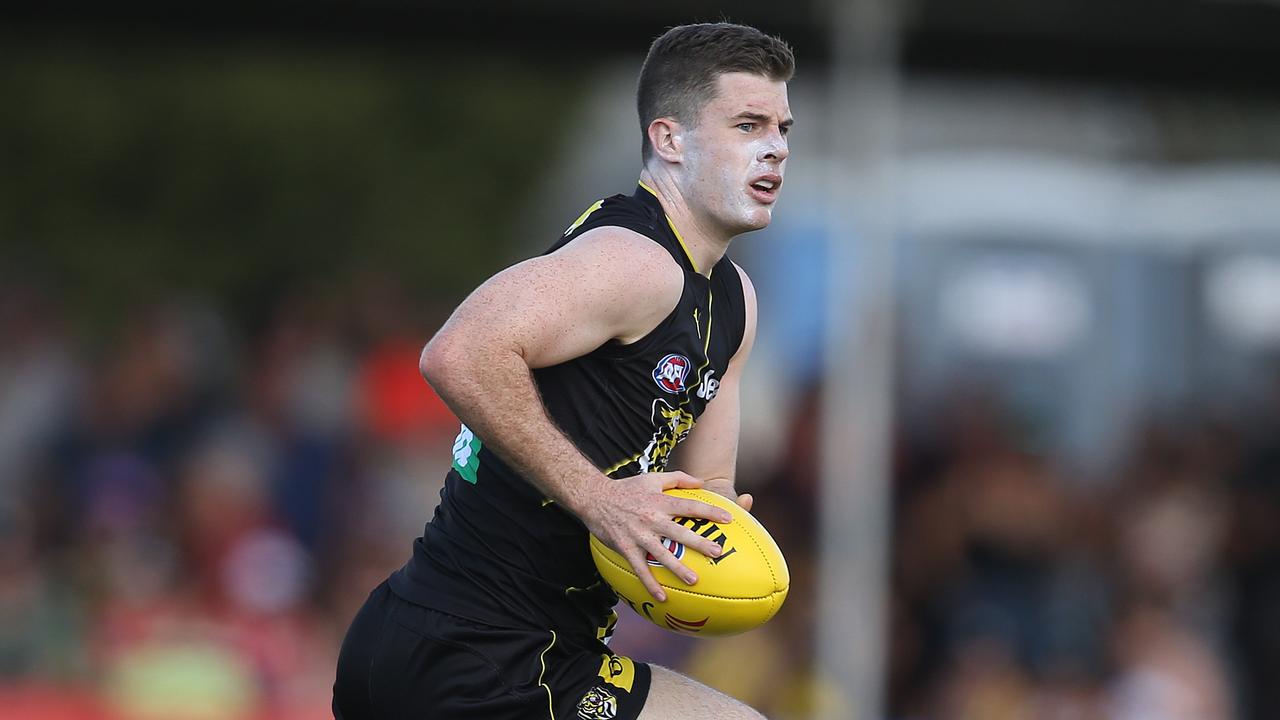 Richmond forward Jack Higgins is in hospital after suffering a brain bleed. Picture: Michael Klein