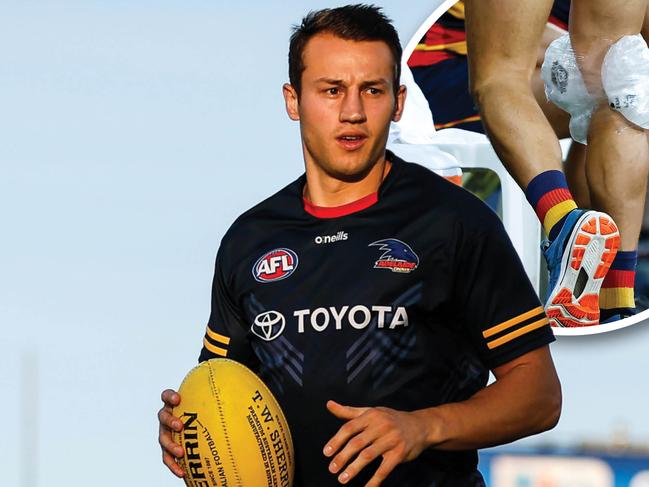 AFL 2023: Tom Doedee hurts knee