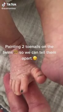 Mum relies on nail polish to tell her twins apart