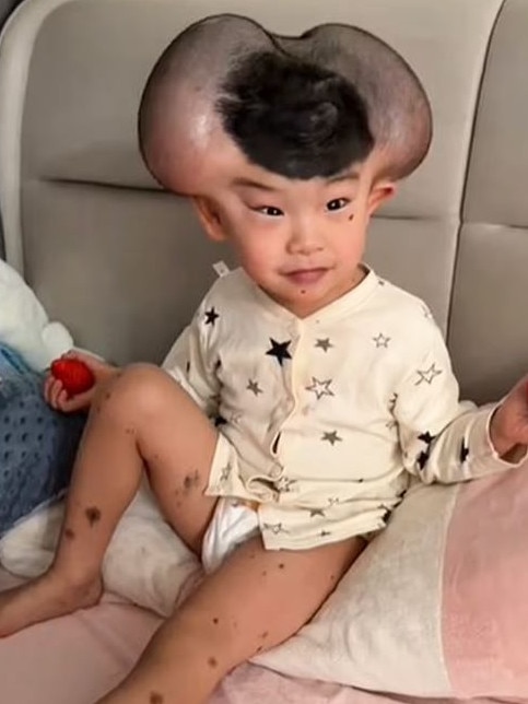 The three-year-old Qibao was cruelly nicknamed 'Mickey Mouse'. Picture: AsiaWire