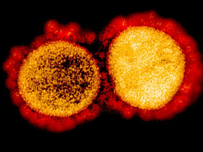 (FILES) In this file undated handout image obtained August 11, 2020, courtesy of the National Institute of Allergy and Infectious Diseases(NIH/NIAID), shows a transmission electron micrograph of SARS-CoV-2 virus particles, isolated from a patient,captured and color-enhanced at the NIAID Integrated Research Facility (IRF) in Fort Detrick, Maryland. - The US biotech firm Eli Lilly on October 7, 2020 announced it was seeking an emergency use authorization (EUA) for its lab-produced antibody treatments against Covid-19, after early trial results showed they reduced viral load, symptoms and hospitalization rates."Our teams have worked tirelessly the last seven months to discover and develop these potential antibody treatments," said Daniel Skovronsky, Lilly's chief scientific officer. (Photo by Handout / National Institute of Allergy and Infectious Diseases / AFP) / RESTRICTED TO EDITORIAL USE - MANDATORY CREDIT "AFP PHOTO /NATIONAL INSTITUTE OF ALLERGY AND INFECTIOUS DISEASES/HANDOUT " - NO MARKETING - NO ADVERTISING CAMPAIGNS - DISTRIBUTED AS A SERVICE TO CLIENTS