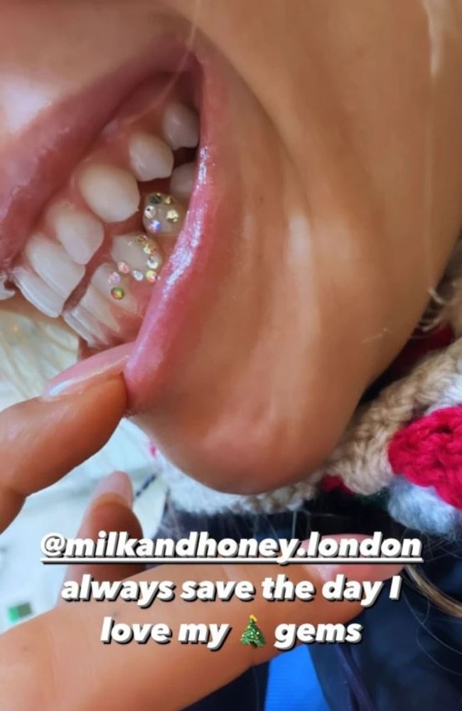 Rita showed off her new tooth gems. Picture: Instagram/ritaora