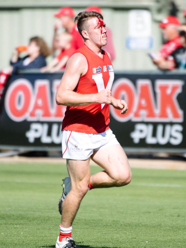 Campbell Combe was among the Roosters’ wounded. Picture: Morgan Sette/AAP