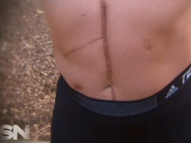 Chris Soteriou was stabbed by his wife. Source: Sunday Night