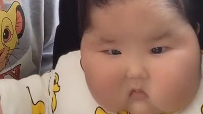 The mother was left horrified after her baby doubled in size and grew hair on her face after she was given steroid cream for her dry skin. Picture: @youzibaobao/Newsflash