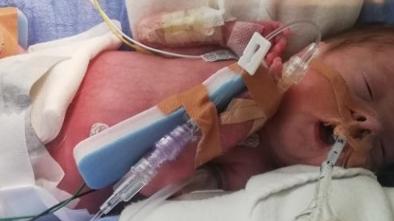 Baby Jack fighting for life.