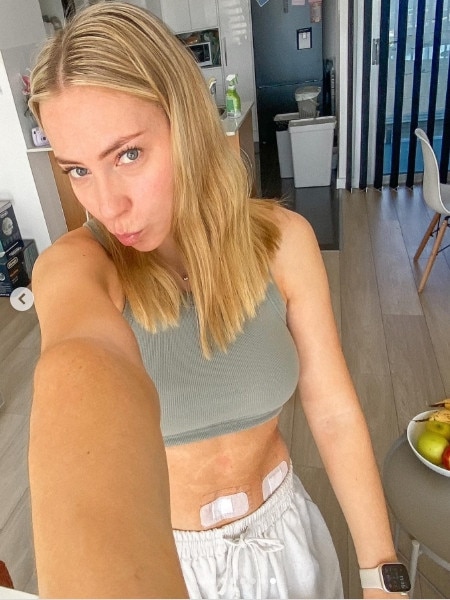 She is actively battling endometriosis, and hopes her transparency online will help others feel less alone in their journey. Picture: @zahramcdonald_