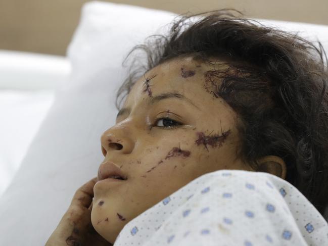 A girl, wounded in an Israeli strike receives treatment in the southern Lebanese village of Saksakiyeh. Picture: AFP.