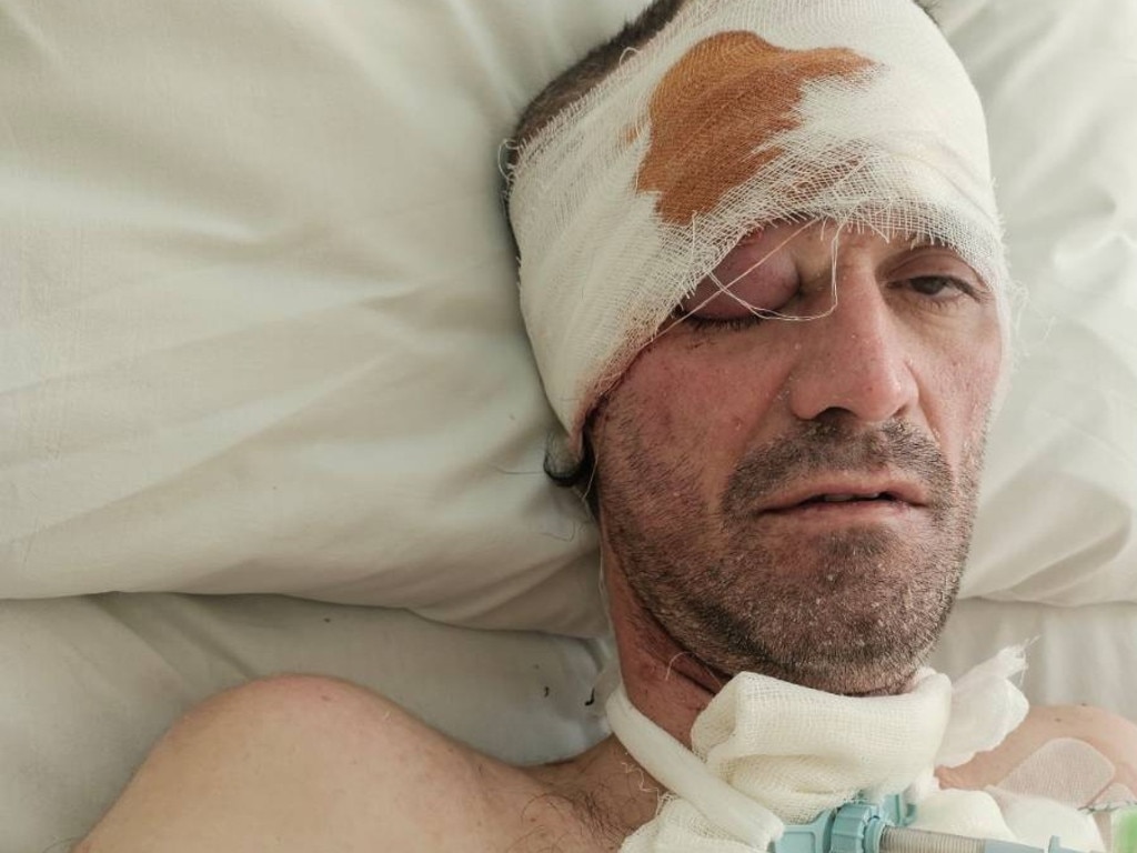 The Gold Coast community is being called upon to rally around beloved local entertainer Brady Mayer, who is facing a long and uncertain recovery after a devastating brain injury earlier this year.