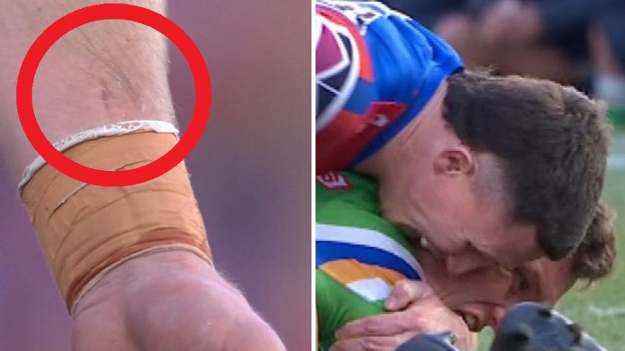 The mark on Gamble’s arm (left) and the moment in question with Wighton on the right.