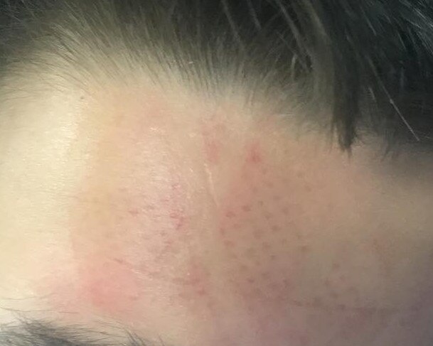 A shoe imprint on the forehead of the 16-year-old victim.