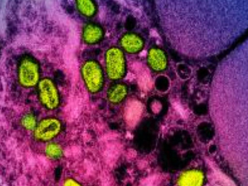 A colourised transmission electron micrograph of monkeypox particles (green) found within an infected cell (pink and purple), cultured in the laboratory. Picture: National Institute of Allergy and Infectious Diseases / AFP