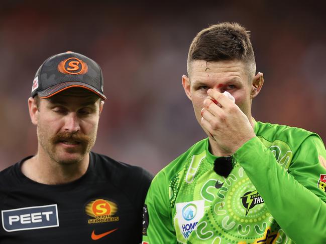 Cameron Bancroft is assisted from the field after the collision. Picture: Getty Images