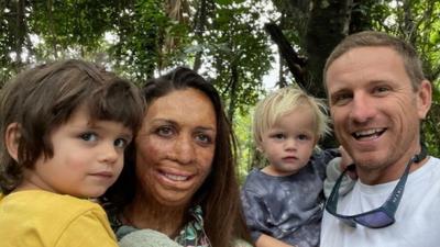 Turia Pitt on 6 months of solo parenting