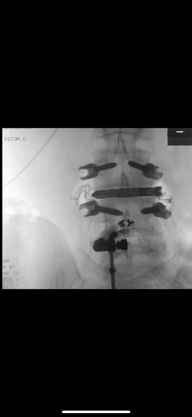 And disc replacement. Picture: Supplied