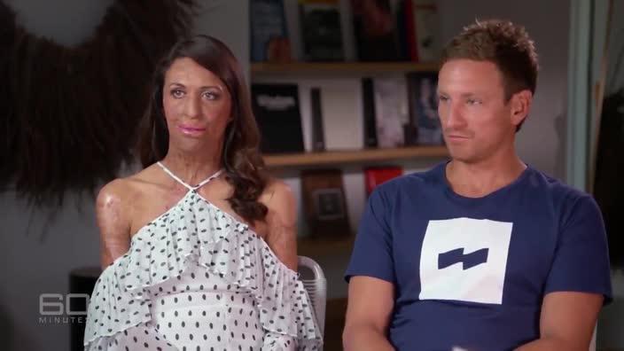 Turia Pitt announces she's having a baby