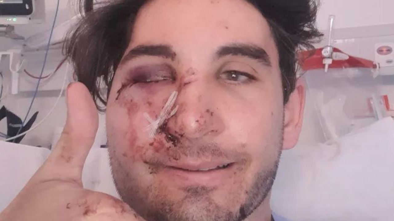 York Danielson alleges a stranger threw a brick at him after an alleged theft in Fremantle on Sunday. Picture: GoFundMe