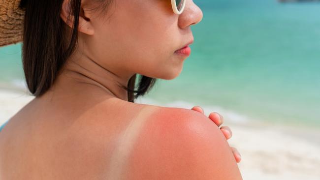 Too many of our young adults are not heeding sun warnings like we did in the ’80s and ’90s. Which is heartbreaking. Picture: istock