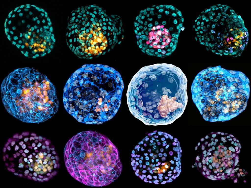 Protein staining highlighting different cell types. Picture: Monash Biomedicine Discovery Institute