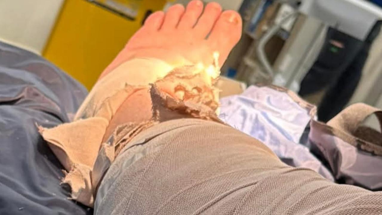 Man rushed to hospital after being bitten by snake